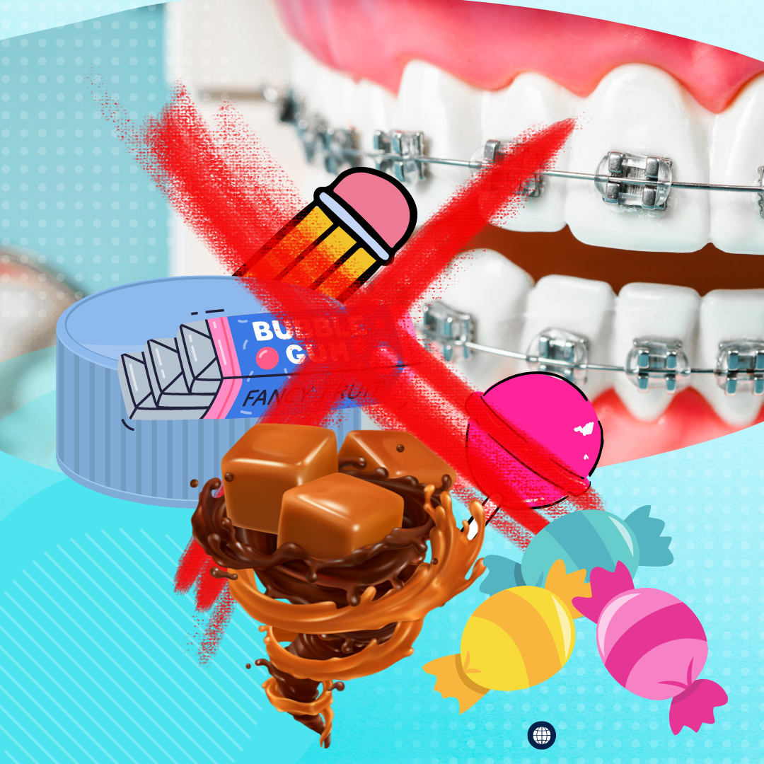 Big no foods — Go Smile Pediatric Dentistry & Orthodontics, Pinellas Park, FL