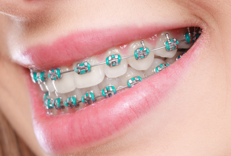 Go Smile Pediatric Dentistry & Orthodontics office in Pinellas Park, Florida
