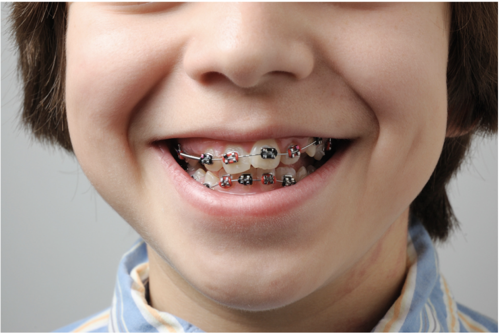 Screen Shot 2025 02 11 at 4.30.41 PM — Go Smile Pediatric Dentistry & Orthodontics, Pinellas Park, FL