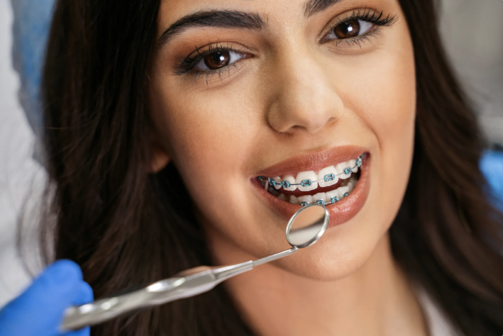 Screen Shot 2025 02 11 at 4.40.41 PM — Go Smile Pediatric Dentistry & Orthodontics, Pinellas Park, FL