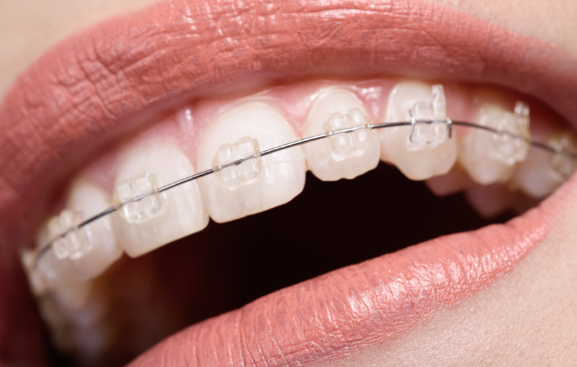 Go Smile Pediatric Dentistry & Orthodontics office in Pinellas Park, Florida