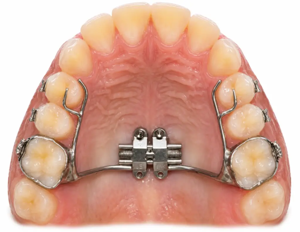 Go Smile Pediatric Dentistry & Orthodontics office in Pinellas Park, Florida