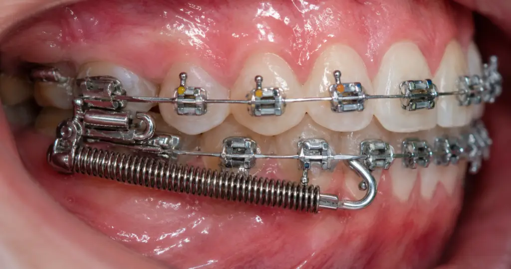Go Smile Pediatric Dentistry & Orthodontics office in Pinellas Park, Florida