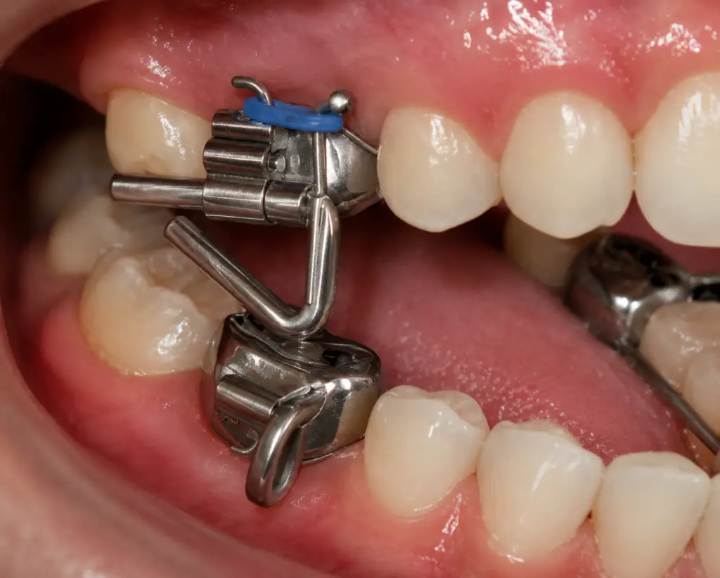Go Smile Pediatric Dentistry & Orthodontics office in Pinellas Park, Florida