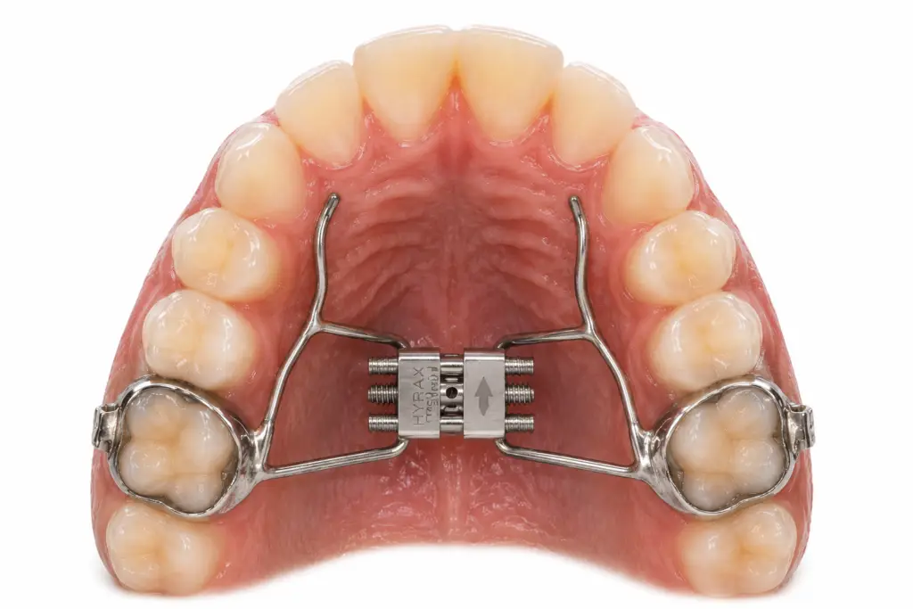 Go Smile Pediatric Dentistry & Orthodontics office in Pinellas Park, Florida